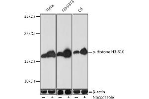Western blot analysis of extracts of various cell lines, using Phospho-Histone H3-S10 Rabbit pAb (ABIN7267687) at 1:1000 dilution.