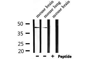 Western blot analysis of extracts from mouse brain, mouse lung, using CEACAM16 Antibody.