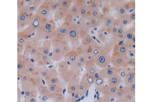 Used in DAB staining on fromalin fixed paraffin- embedded liver tissue