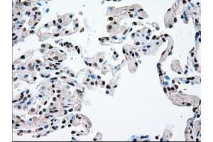 Image no. 9 for anti-TYRO3 Protein Tyrosine Kinase (TYRO3) antibody (ABIN1501605)