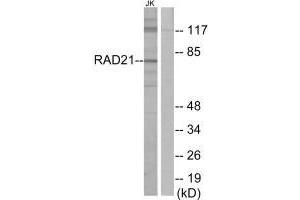 Western blot analysis of extracts from Jurkat cells, using RAD21 antibody. (RAD21 anticorps)