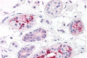 anti-Biorientation of Chromosomes in Cell Division 1-Like 1 (BOD1L1) (AA 2802-2815) antibody