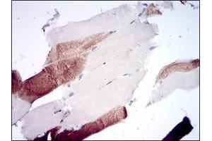 Immunohistochemical analysis of paraffin-embedded human muscle tissues using RPTOR mouse mAb with DAB staining.