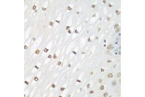 Immunohistochemistry of paraffin-embedded human esophagus using FOSL2 antibody (ABIN3016548, ABIN3016549, ABIN3016550 and ABIN6219779) at dilution of 1:100 (40x lens). (FOSL2 anticorps  (AA 187-326))