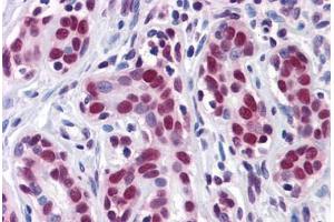 Human Breast: Formalin-Fixed, Paraffin-Embedded (FFPE)