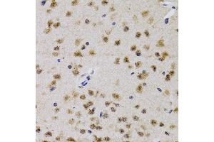Immunohistochemistry of paraffin-embedded mouse brain using CDK7 antibody (ABIN3022404, ABIN3022405, ABIN3022406 and ABIN6218792) at dilution of 1:200 (40x lens).