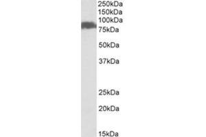Western Blotting (WB) image for anti-Solute Carrier Family 26, Member 6 (SLC26A6) (Internal Region) antibody (ABIN1449464) (SLC26A6 anticorps  (Internal Region))
