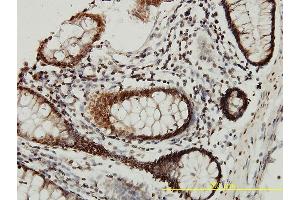 Immunoperoxidase of monoclonal antibody to CSTB on formalin-fixed paraffin-embedded human colon tissue.
