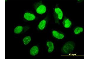Immunofluorescence of monoclonal antibody to EIF2AK2 on HeLa cell.