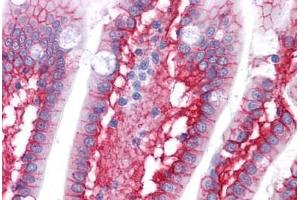 Human Small Intestine: Formalin-Fixed, Paraffin-Embedded (FFPE) (CTNNB1 anticorps)