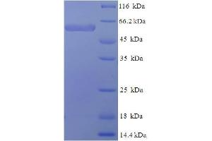 SDS-PAGE (SDS) image for SWI/SNF Related, Matrix Associated, Actin Dependent Regulator of Chromatin, Subfamily B, Member 1 (SMARCB1) (AA 2-376), (partial) protein (His-SUMO Tag) (ABIN5711321)