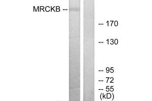 Western Blotting (WB) image for anti-CDC42 Binding Protein Kinase beta (DMPK-Like) (CDC42BPB) (C-Term) antibody (ABIN1850128) (CDC42BPB anticorps  (C-Term))