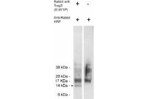 Image no. 1 for anti-CSAG Family, Member 2 (CSAG2) antibody (ABIN265186) (CSAG2 anticorps)