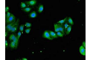 Immunofluorescent analysis of HepG2 cells using ABIN7142825 at dilution of 1:100 and Alexa Fluor 488-congugated AffiniPure Goat Anti-Rabbit IgG(H+L)