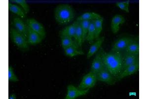 Immunofluorescence staining of HepG2 cells with ABIN7147234 at 1:50, counter-stained with DAPI. (CDK5RAP3 anticorps  (Regulatory Subunit))
