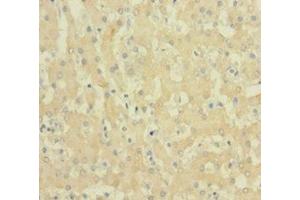Immunohistochemistry of paraffin-embedded human liver tissue using ABIN7152719 at dilution of 1:100 (FTL anticorps  (AA 2-175))