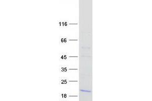 Validation with Western Blot