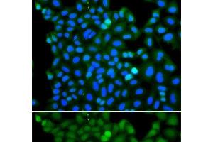 Immunofluorescence analysis of A549 cells using RNF125 Polyclonal Antibody (RNF125 anticorps)