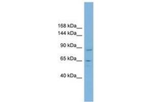 Image no. 1 for anti-TBC1 Domain Containing Kinase (TBCK) (AA 287-336) antibody (ABIN6742114)