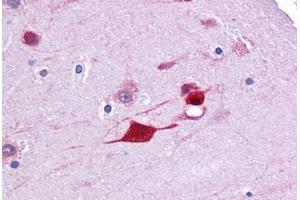 Human Brain, Cortex: Formalin-Fixed, Paraffin-Embedded (FFPE)