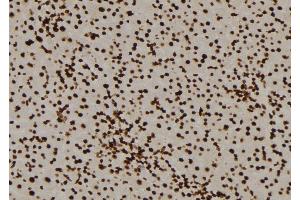 ABIN6276477 at 1/100 staining Mouse liver tissue by IHC-P. (PPP3CA anticorps  (N-Term))