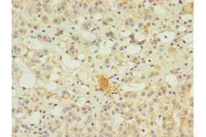Immunohistochemistry of paraffin-embedded human adrenal gland tissue using ABIN7169349 at dilution of 1:100 (SERPINB8 anticorps  (AA 60-242))