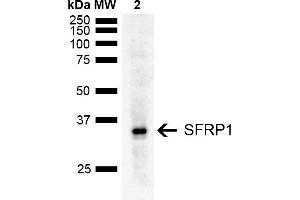 Western blot analysis of Rat Liver showing detection of ~35 kDa SFRP1 protein using Rabbit Anti-SFRP1 Polyclonal Antibody (ABIN5667734). (SFRP1 anticorps  (AA 1-100) (FITC))