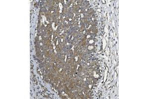 IHC analysis of ULBP1 using anti ULBP1 antibody (ABIN7600996). (ULBP1 anticorps  (AA 27-209))
