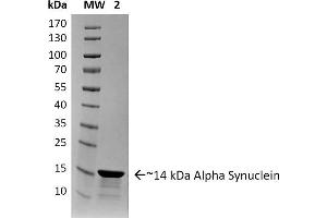 SDS-PAGE of ~14 kDa Human Recombinant Alpha Synuclein Protein Aggregate (Control) .