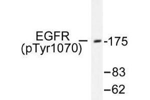 Image no. 1 for anti-Epidermal Growth Factor Receptor (EGFR) (pSer1070) antibody (ABIN318325) (EGFR anticorps  (pSer1070))