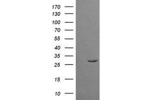 Image no. 1 for anti-Tripartite Motif Containing 38 (TRIM38) (AA 1-265) antibody (ABIN1490688) (TRIM38 anticorps  (AA 1-265))
