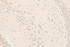 Immunohistochemistry analysis of paraffin-embedded rat hippocampus using,TBXT (ABIN7075815) at dilution of 1: 3200