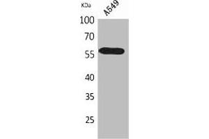 Western Blot analysis of A549 cells using ALDH2 Polyclonal Antibody. (ALDH2 anticorps  (N-Term))