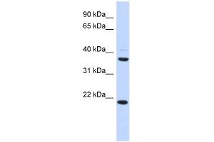 WB Suggested Anti-TMEM74 Antibody Titration: 0. (TMEM74 anticorps  (Middle Region))