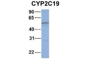 Host:  Rabbit  Target Name:  WT1  Sample Type:  721_B  Antibody Dilution:  1.