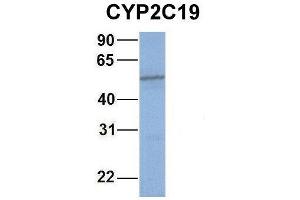 Host:  Rabbit  Target Name:  WT1  Sample Type:  721_B  Antibody Dilution:  1. (CYP2C19 anticorps  (Middle Region))