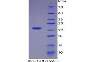 SDS-PAGE of Protein Standard from the Kit  (Highly purified E. (MMP3 Kit ELISA)