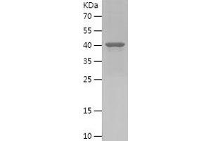Western Blotting (WB) image for Pleckstrin Homology Domain Containing, Family B (Evectins) Member 1 (PLEKHB1) (AA 30-199) protein (His-IF2DI Tag) (ABIN7124485)