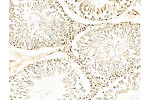 ABIN6258847 and ABIN6275709 at 1/100 staining Rat testis tissue by IHC-P. (RAD23B anticorps  (N-Term))