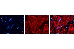 Rabbit Anti-CPT2 Antibody   Formalin Fixed Paraffin Embedded Tissue: Human heart Tissue Observed Staining: Cytoplasmic in mitochondria Primary Antibody Concentration: 1:100 Other Working Concentrations: 1:600 Secondary Antibody: Donkey anti-Rabbit-Cy3 Secondary Antibody Concentration: 1:200 Magnification: 20X Exposure Time: 0.