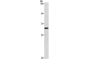 Western Blotting (WB) image for anti-Ceramide Kinase-Like (CERKL) antibody (ABIN2432841)