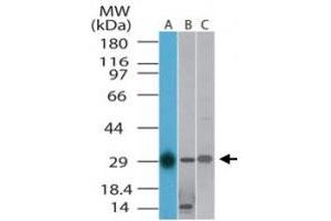 Western blot analysis of TLX1 in A) human, B) mouse and C) rat liver lysate. (TLX1 anticorps  (AA 300-330))