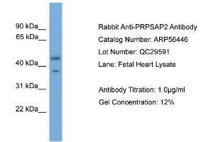 WB Suggested Anti-PRPSAP2  Antibody Titration: 0. (PRPSAP2 anticorps  (Middle Region))