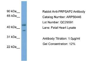WB Suggested Anti-PRPSAP2  Antibody Titration: 0. (PRPSAP2 anticorps  (Middle Region))