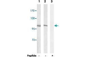 Western blot analysis of extracts from A-549 cells (Lane 1 and lane 3) and NIH/3T3 cells (Lane 2), using CNGB1 polyclonal antibody . (GARP anticorps)