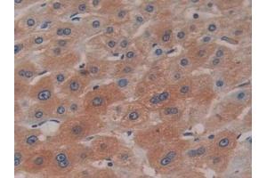 Detection of CP in Human Liver Tissue using Monoclonal Antibody to Ceruloplasmin (CP)