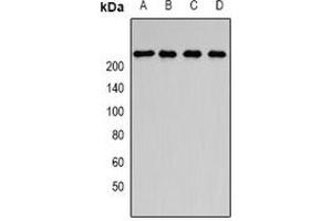 Western blot analysis of SMCHD1 expression in SKOV3 (A), Jurkat (B), HepG2 (C), rat brain (D) whole cell lysates. (SMCHD1 anticorps)