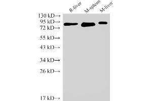 Western Blot analysis of Rat liver, Mouse spleen and Mouse liver using IL6R Polyclonal Antibody at dilution of 1:2000 (IL-6 Receptor anticorps)