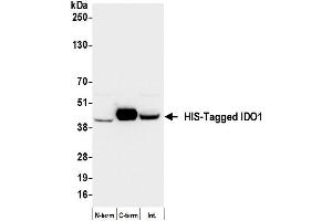 Western Blotting (WB) image for anti-His Tag antibody (ABIN7795586) (Recombinant His Tag anticorps)