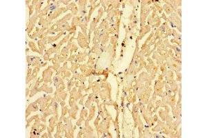 Immunohistochemistry of paraffin-embedded human heart tissue using ABIN7146833 at dilution of 1:100 (CPT1A anticorps  (AA 301-600))